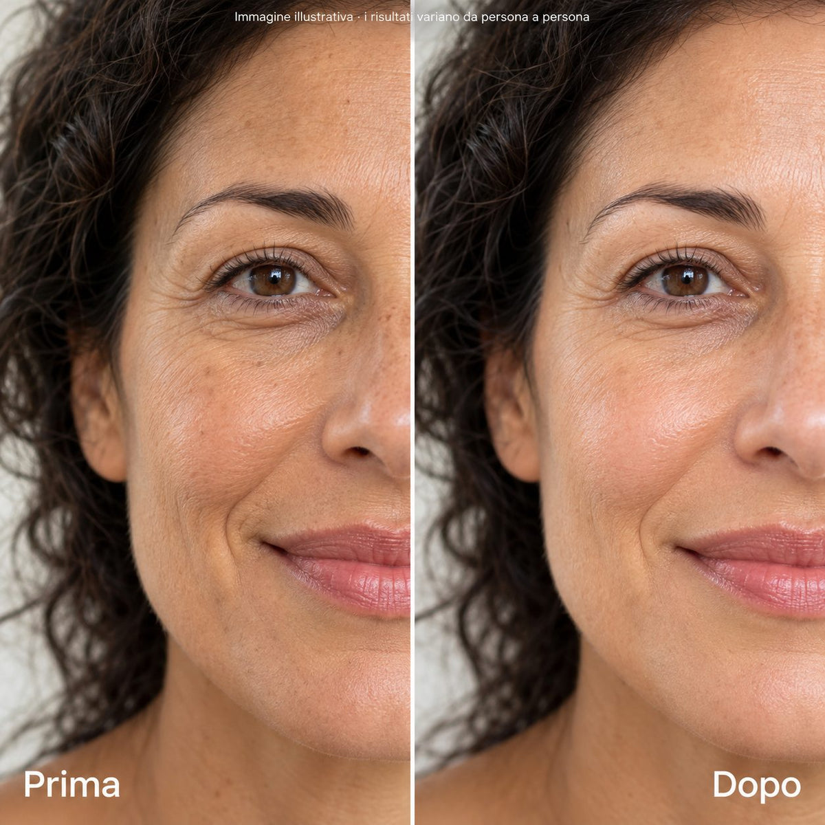 Linee del sorriso · Stick